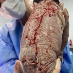 😱😱Baby born with an DIU peg… See more